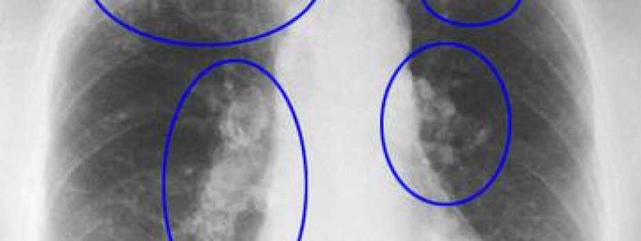 Mining Index Zimbabwe